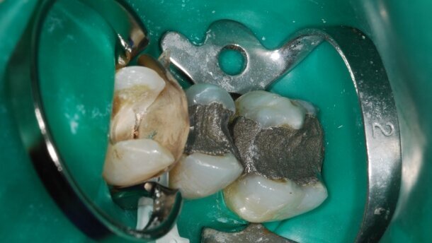 Résultats du sondage sur les systèmes de matrices sectorielles