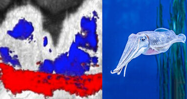 New research uses squid ink to check for periodontal disease