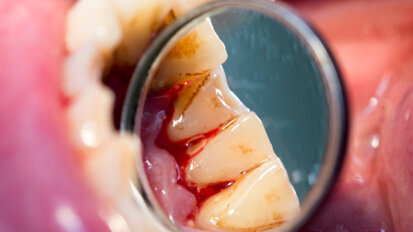 Is it time to re-unite the mouth with the rest of the body?