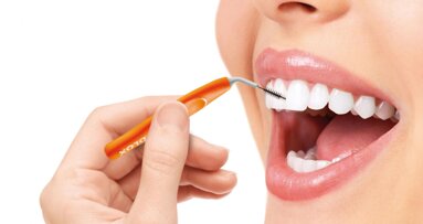 La higiene interdental en el cuidado de los implantes