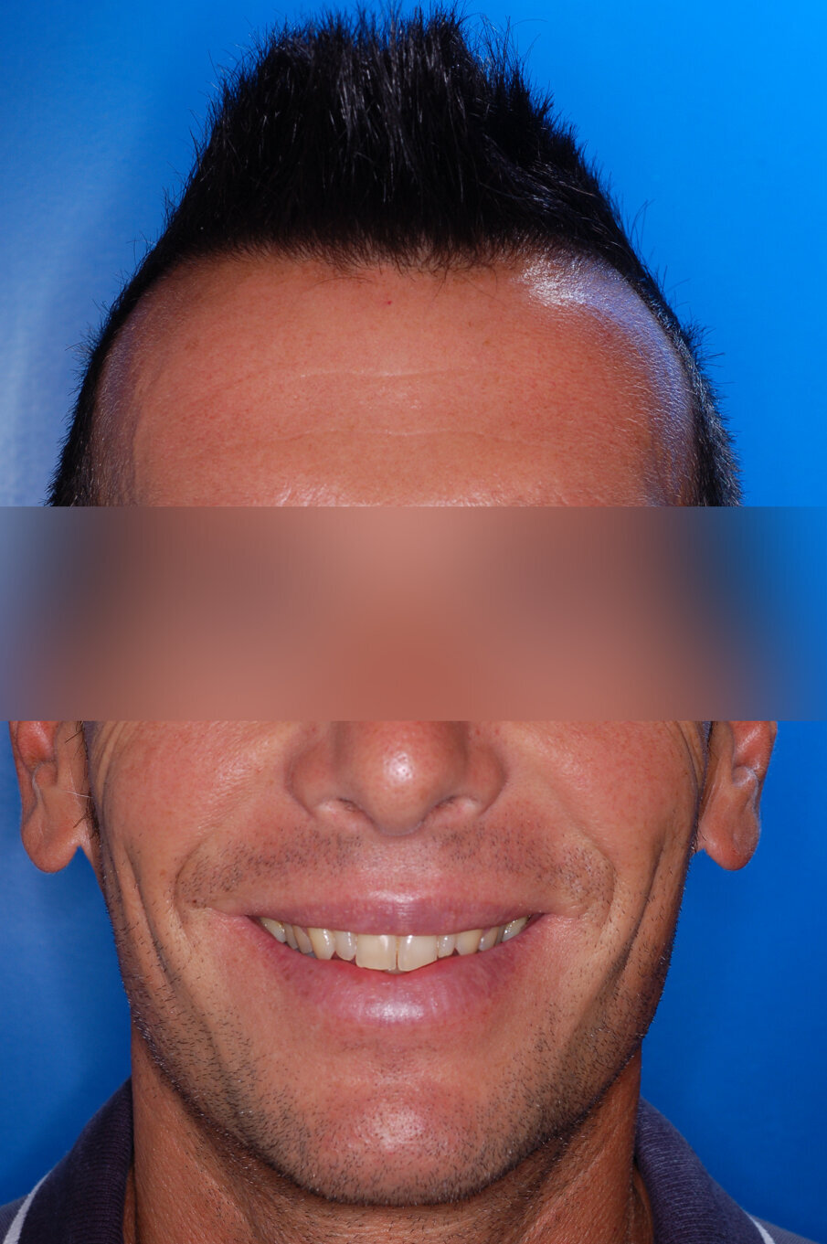 Figg. 51-58_Fotografie facciali e intraorali post-trattamento.