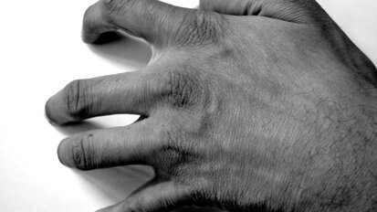 Valutazione del rischio stress nello Studio del dentista