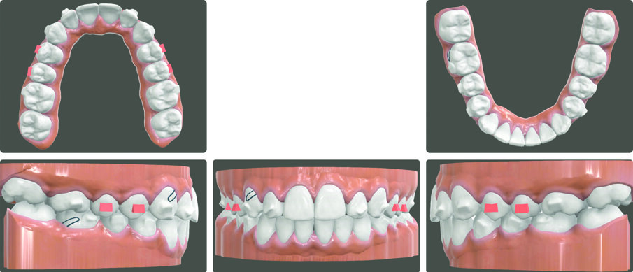 Fig. 3
