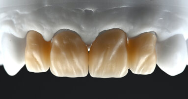 Une formule simple pour de merveilleux sourires