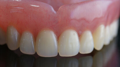 Quality of life study of denture and dental implant patients launched