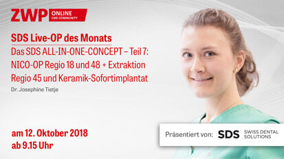 Live-OP am 12. Oktober: Das SDS ALL-IN-ONE-CONCEPT – Teil 7 Live-OP am 12. Oktober: Das SDS ALL-IN-ONE-CONCEPT – Teil 7
