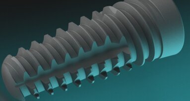 Neoss lancia sul mercato gli impianti Neoss ProActive Edge