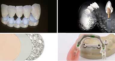 Materiál nové generace – BioHPP, který vyvinula firma bredent GmbH