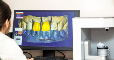 Interview on evaluating the costs of adding 3D printing to the dental practice