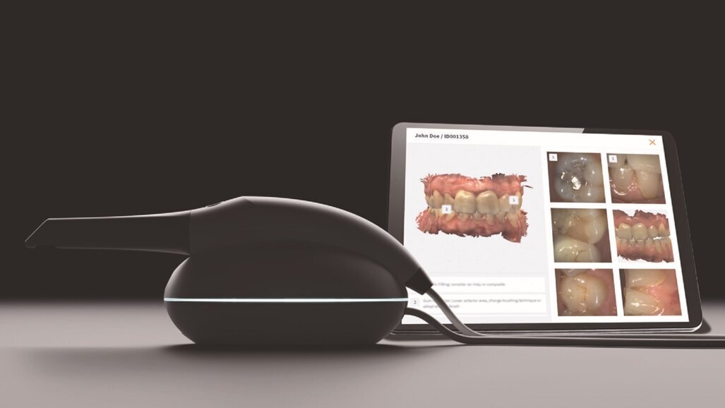 3DISC reinvents the intra-oral scanner with OVO