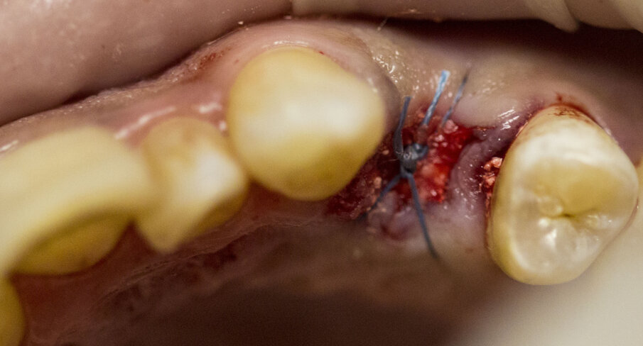 Fig. 8 - Sutura post-op.
