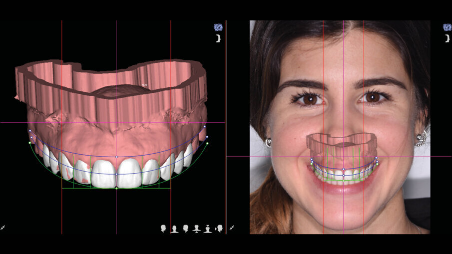 Figg. 5a-6b_Valutazione iniziale.