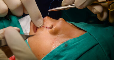 Children with clefts to receive improved oral healthcare