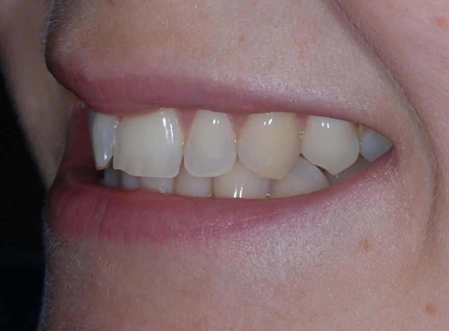 Fig. 3: Pre treatment left lateral