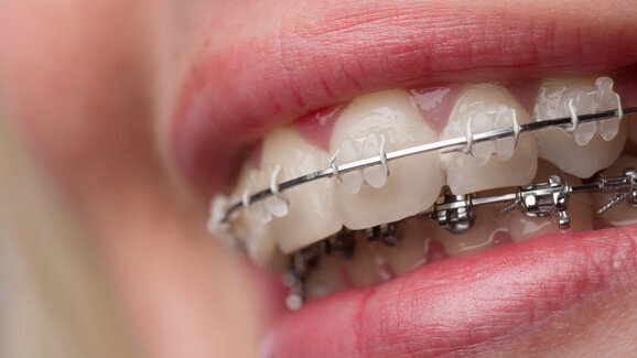 KFO im Fokus des Bayerischen Zahnärztetages