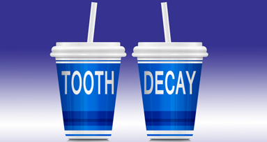 Zahnerosion: Studie entlarvt Zucker und Kohlensäure als größte Übeltäter