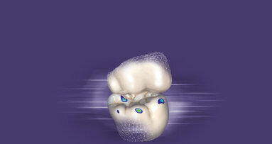 Reduce design time with exocad’s DentalCAD 3.1 Rijeka software