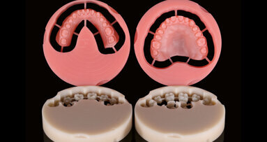 Celkové náhrady kompletně zhotovené metodou CAD/CAM