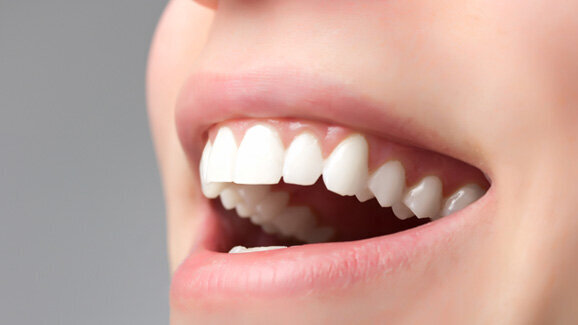 Rheinland-Pfälzer haben gesunde Zähne