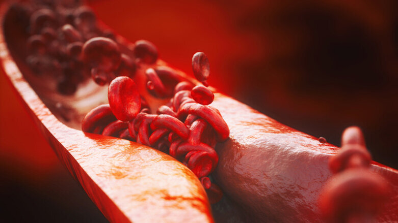 Mundgesundheit beeinflusst Herzgesundheit