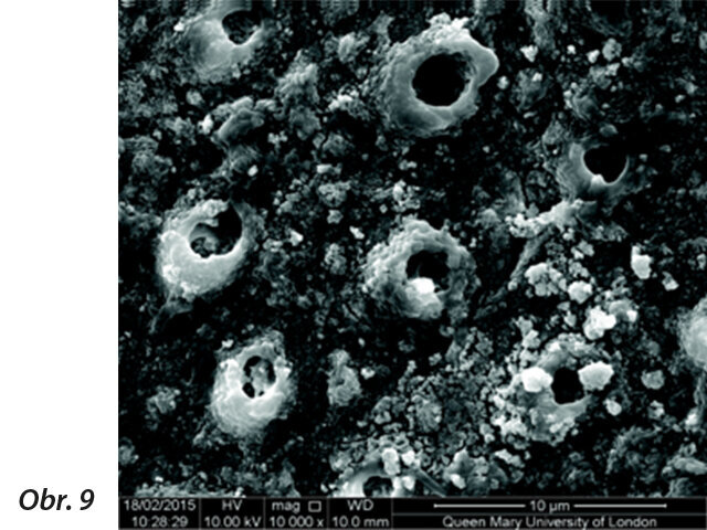 Obr. 9: Uzavřené kanálky po čištění pastou BioMin F (výzkum na Queen Mary University of London).