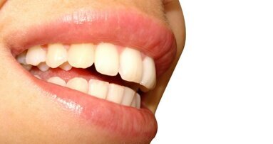 Movimento dentale: scienza della salute o eccessiva cosmetica?