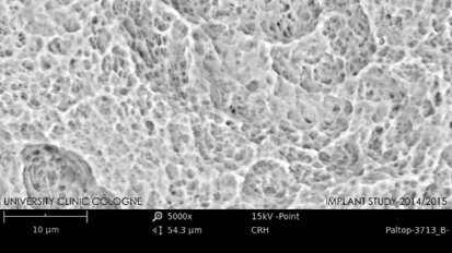 Impianti dentali privi di impurità sono essenziali per il successo clinico