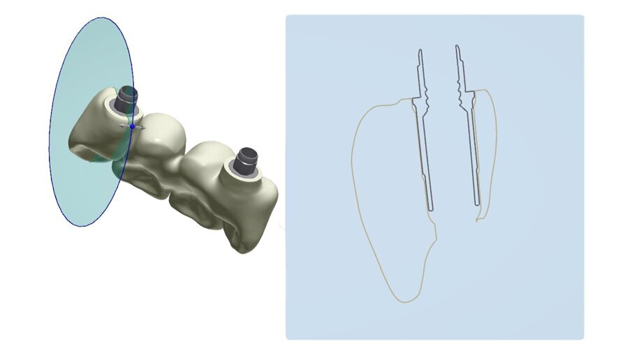 Fig. 40_Anche la scelta dell’altezza del t-base è un’altra determinate al manufatto finale.