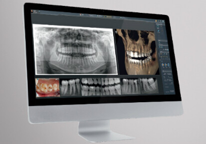 Dentsply Sirona – SIDEXIS 4