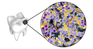 Researchers sequence rare bacterium that causes rampant dental caries