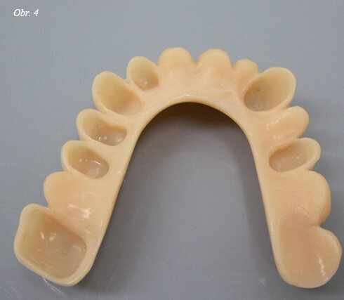 Obr. 4