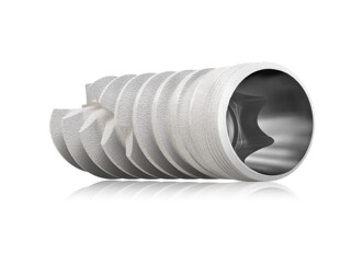 Keystone Dental Group – Prima Plus Conical Implants