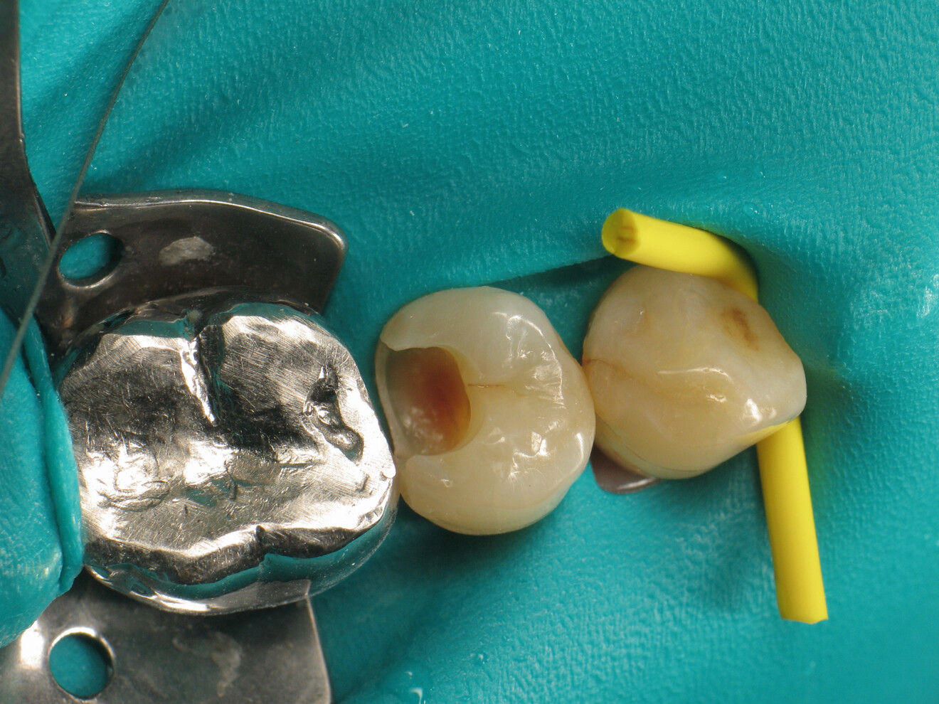 Fig. 3: Cavity after excavation.