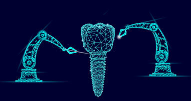 Allisone Technologies now offers dental implant recognition with acquisition of Spotimplant