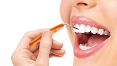 La higiene interdental en el cuidado de los implantes