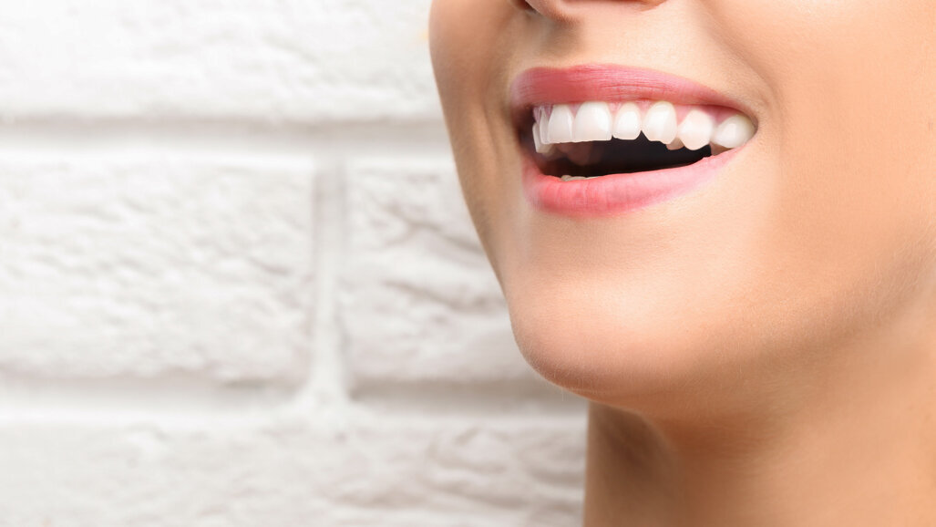 Il nuovo orientamento all’estetica e la ricerca dei “denti bianchi”