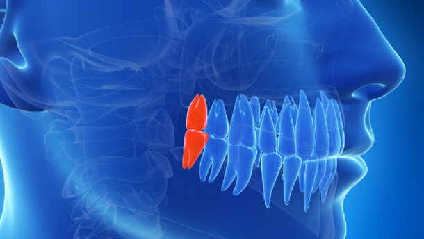 ADF 2014 : conférence « La dent de sagesse »