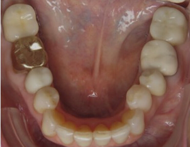 Fig. 6b