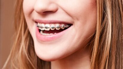 Orthodontisch kwaliteitsregister voor tandartsen
