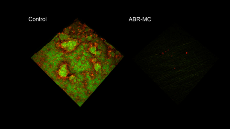 New dental material resists plaque and kills microbes