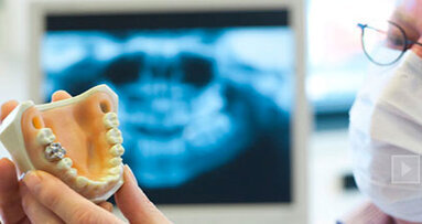 Dental association raises awareness as implant industry grows