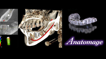 Anatomage è Finalmente Presente in Europa!
