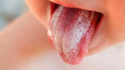 Nuove sostanze per il controllo delle risposte infiammatorie provocate da infezioni fungine