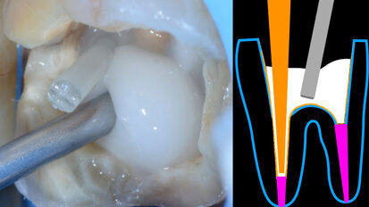 Der Vorteil von Bioaktivität: Bessere Ergebnisse durch biochemische Stimulierung