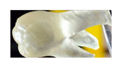 Stampati e senza carie: i nostri denti del futuro