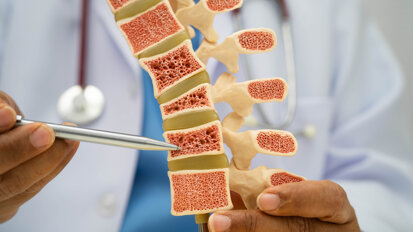 Periodontitis may worsen systemic bone loss via gut microbiota