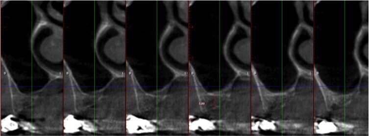 Fig. 4 - Cross section di zona 25.