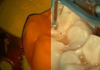 ZEISS TrueLight & NoGlare Mode of ZEISS EXTARO 300