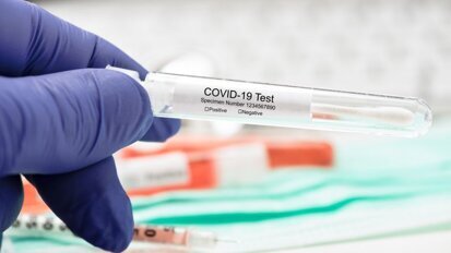 Laten testen bij milde klachten