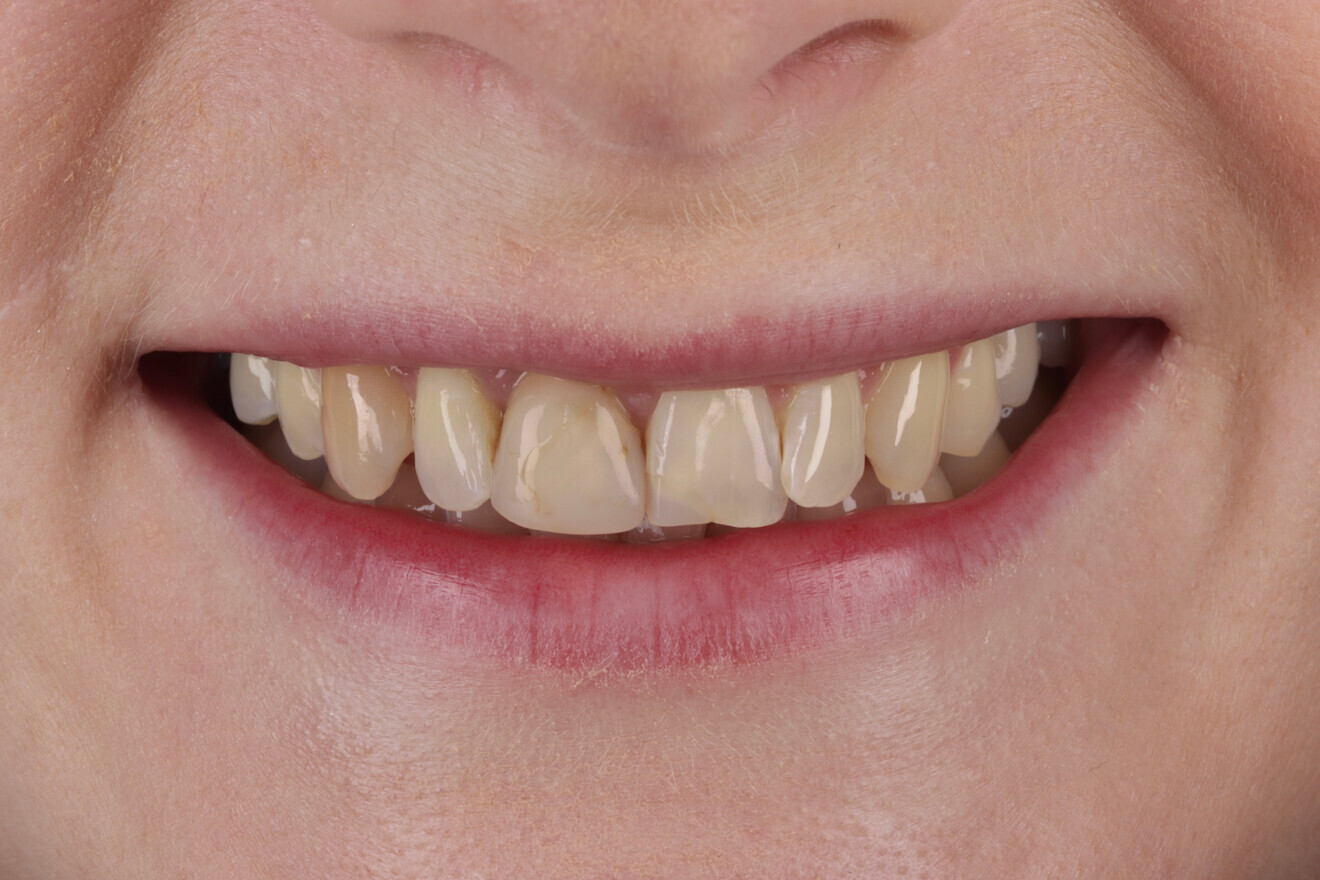 Patient prior to treatment. (Image: Freshdental) 